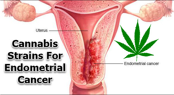 CANNABIS FOR ENDOMETRIAL CANCER