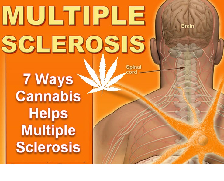 MARIJUANA FOR MS