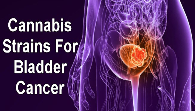 CANNABIS FOR BLADDER CANCER