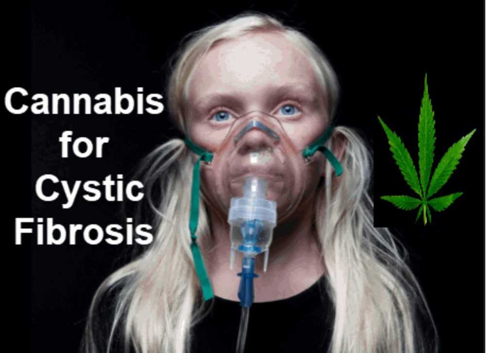 MEDICAL MARIJUANA USED TO TREAT CYSTIC FIBROSIS