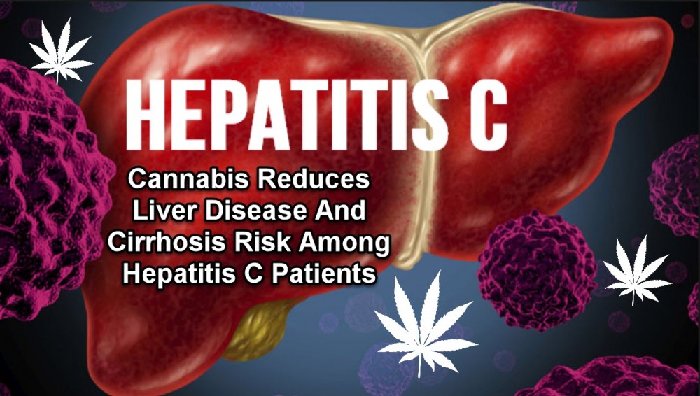 LIVER AND HEP C PATIENTS MEDICAL MARIJUANA