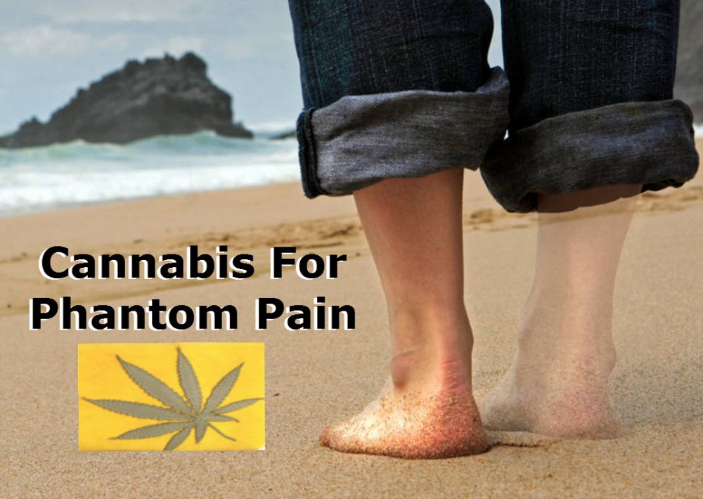 MEDICAL MARIJUANA FOR PHANTOM LIMB PAIN