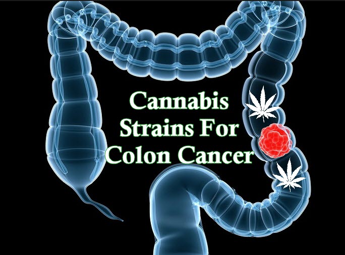 CANNABIS STRAINS FOR COLON CANCER