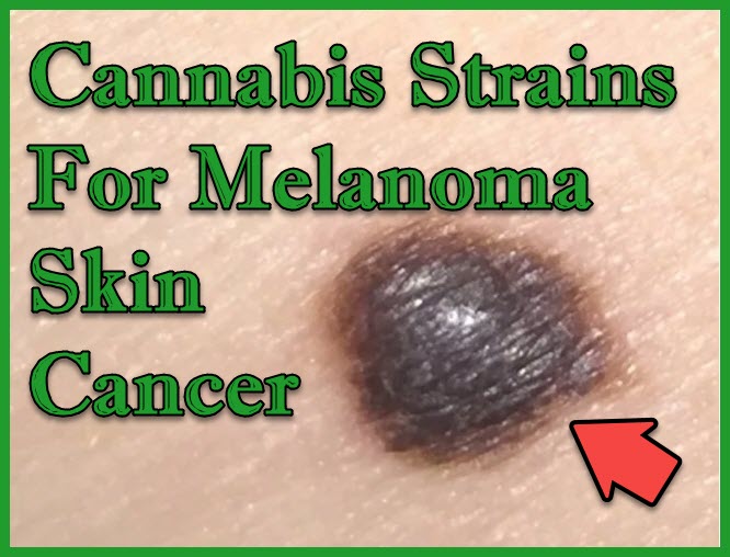 STRAINS FOR MELANOMA