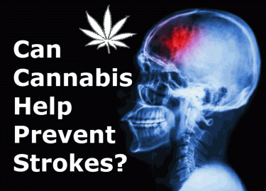 CANNABIS FOR STROKE VICTIMS