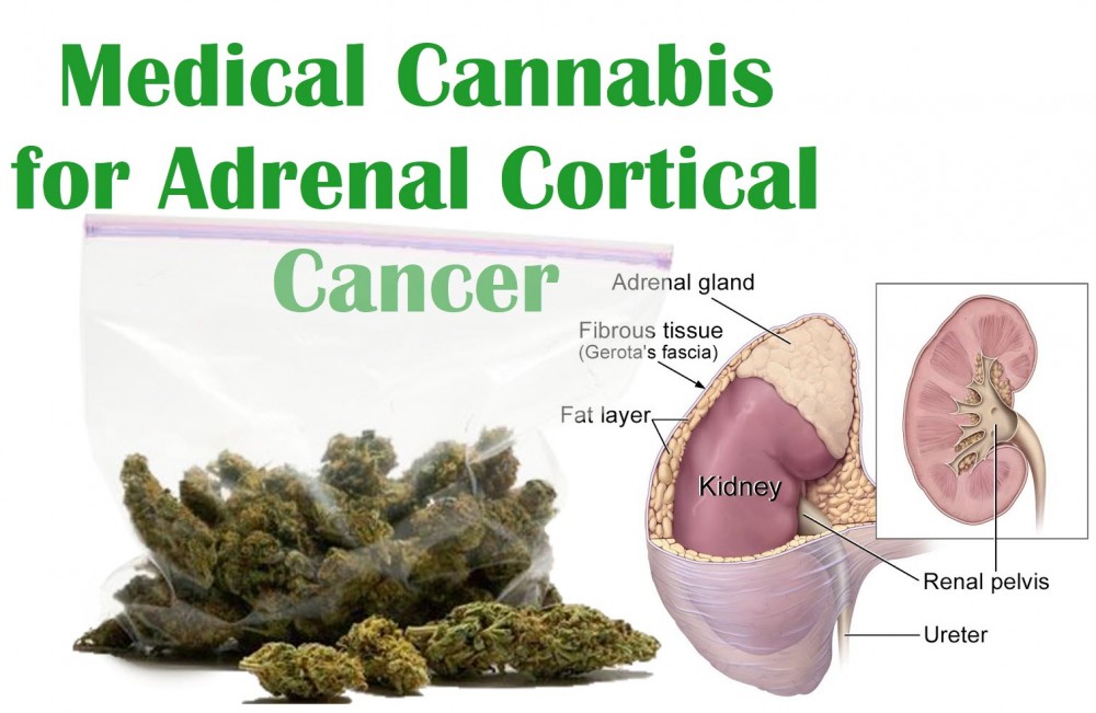 medical marijuana for adrenral cortex cancer