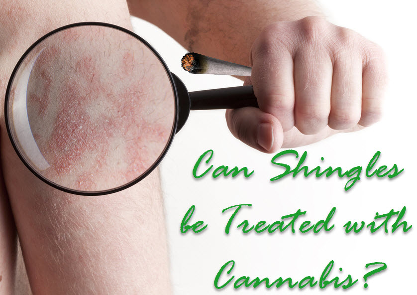 MARIJUANA AND SHINGLES