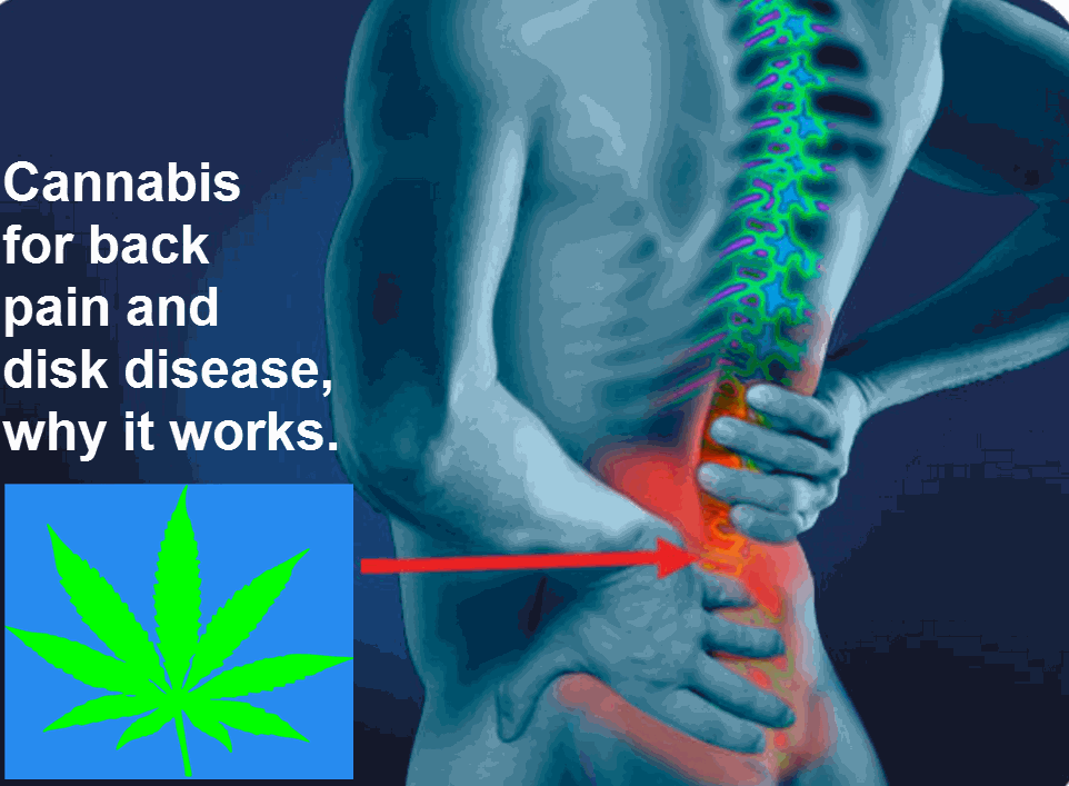 CANNABIS FOR DISK BACK PAIN