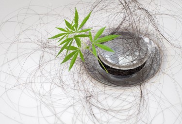 cannabis alopecia