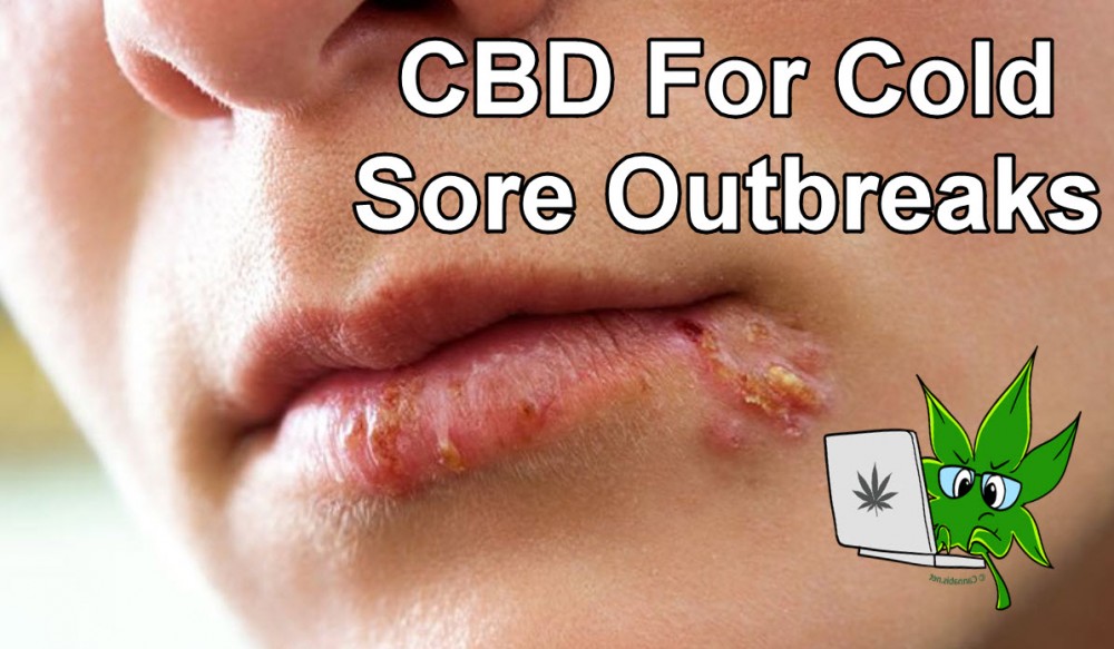 cbd cold sores