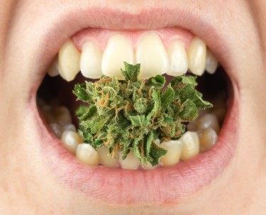 cbd for dentists