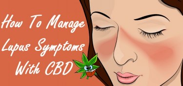 CBD TO TREAT LUPUS