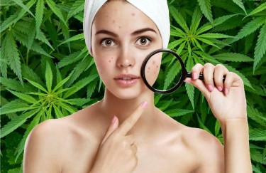 cbd oil for acne oil