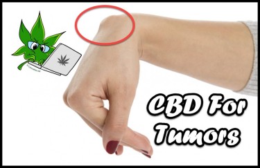 CBD FOR TUMOR GROWTH IN HUMANS
