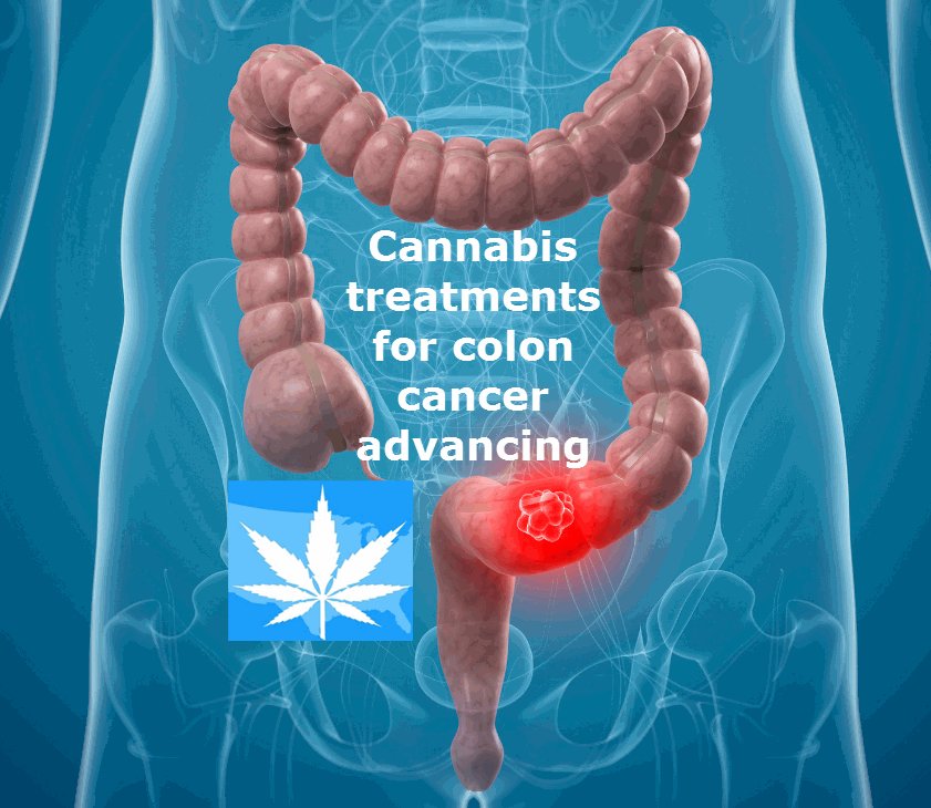 CANNABIS FOR COLON CANCER