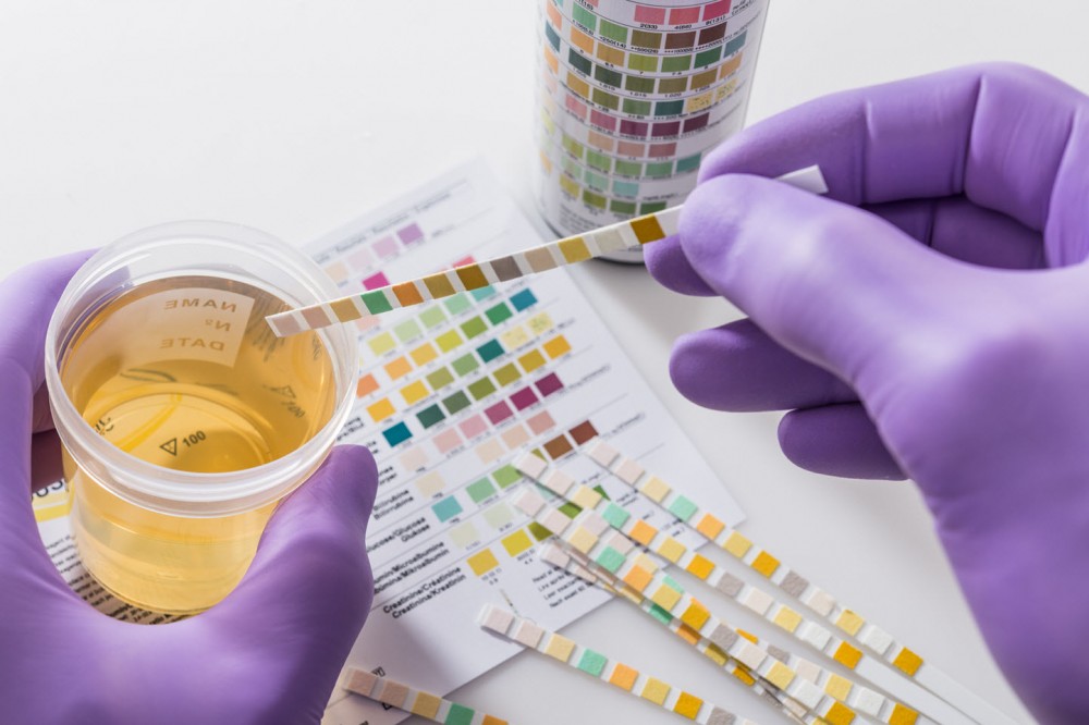 Does Nova Medical Center Test For Synthetic Urine