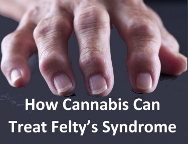 treat felty's syndrome marijuana
