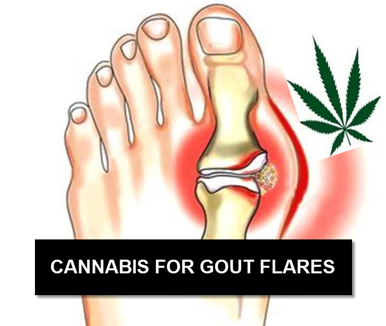 DOES MARIJUANA HELP WITH GOUT