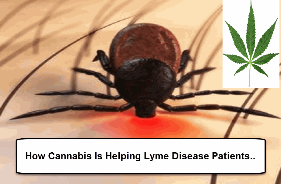 LYME AND CANNABIS MEDICAL MARIJUANA