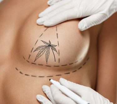 marijuana breast implant surgery