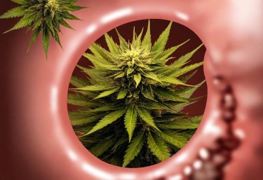 colon cancer and marijuana use