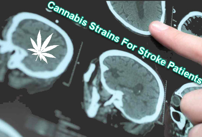 cannabis for strokes