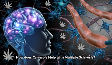 CANNABIS FOR MS