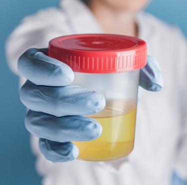 How Long Does Marijuana Stay In Your Urine Asking For A Friend How Long Does Marijuana Stay In Your Urine Asking For A Friend