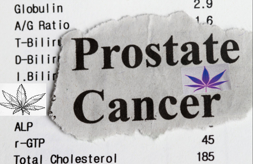 CANNABIS FOR PROSTATE CANCER PATIENTS