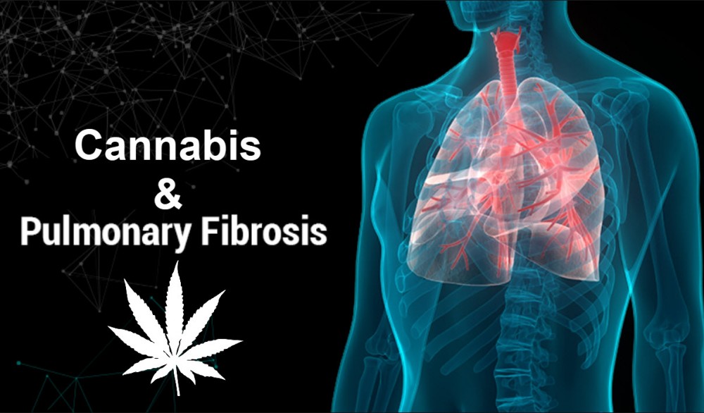 PULMONARY FIBROSIS AND CANNABIS