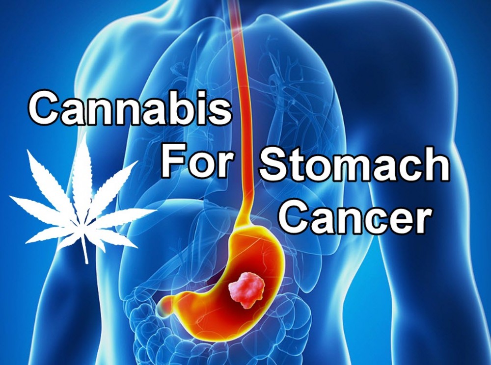 CANNABIS AND STOMACH CANCER
