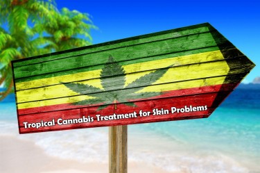 TROPICAL CANNABIS FOR SKIN PROBLEMS