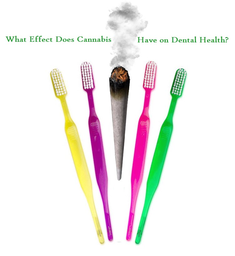 CANNABIS DENTAL HEALTH